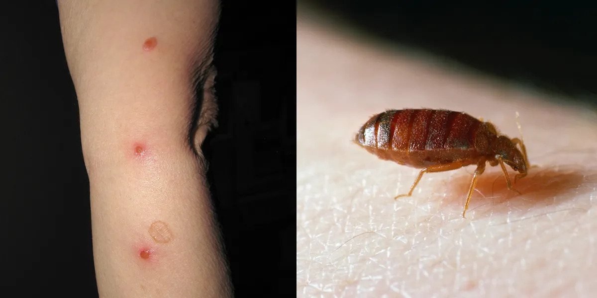 Can I have bed bugs even if I can’t see them?